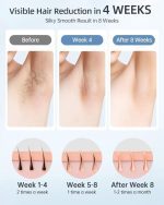دستگاه لیزر شاتی Glattol IPL 3in 1  سطح انرژی  9 و 2 حالت فلاش، با باد خنک سفید - تصویر 3