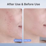 ماسک نور درمانی صورت قرمز، صورت LED با نور مادون قرمز چهار تراشه‌ای ۲۸۰ LED - تصویر 2