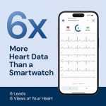 دستگاه نوار قلب AliveCor KardiaMobile 6L  شخصی  (ECG) ۶ لیده با تأییدیه CE - تصویر 9